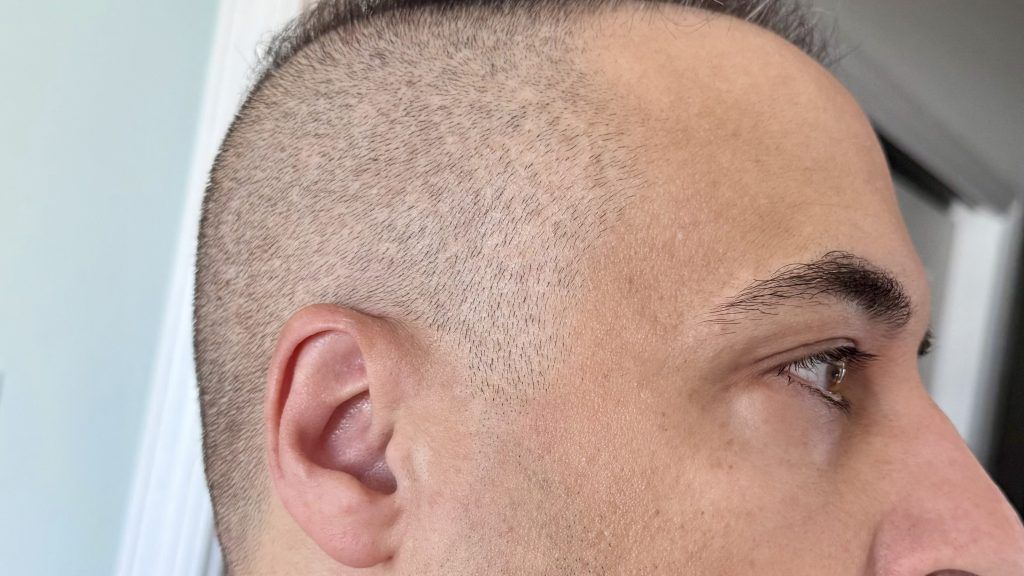 After using the MAXGROOM Hair Clippers Set (WF-3908).